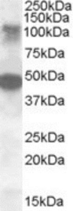 STK11IP Antibody, Novus Biologicals 0.1mg; Unlabeled:Antibodies, Polyclonal