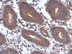 STK16 Antibody, Novus Biologicals 0.1mL; Unlabeled:Antibodies, Polyclonal