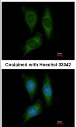 STK25 Antibody, Novus Biologicals 0.1mL; Unlabeled:Antibodies, Polyclonal
