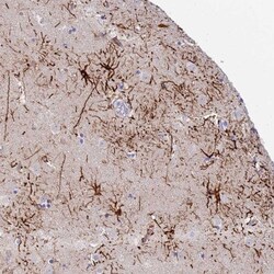 STK25 Antibody, Novus Biologicals 0.1mL; Unlabeled:Antibodies, Polyclonal