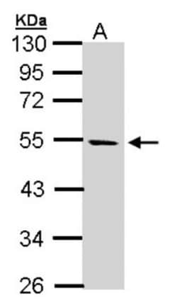 STK25 Antibody, Novus Biologicals 0.1mL; Unlabeled:Antibodies, Polyclonal
