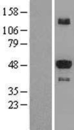 Novus Biologicals&trade;&nbsp;STK25 Overexpression Lysate