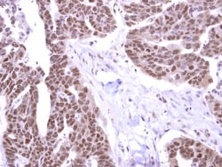STK31 Antibody, Novus Biologicals 0.1mL; Unlabeled:Antibodies, Polyclonal