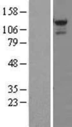 Novus Biologicals&trade;&nbsp;STK31 Overexpression Lysate