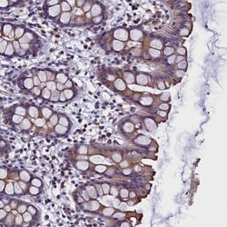 STK32A Antibody, Novus Biologicals 0.1mL; Unlabeled:Antibodies, Polyclonal
