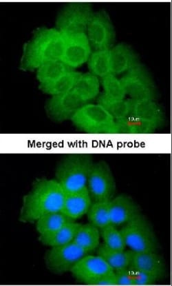 STK32C Antibody, Novus Biologicals 0.1mL; Unlabeled:Antibodies, Polyclonal