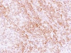 STK32C Antibody, Novus Biologicals 0.1mL; Unlabeled:Antibodies, Polyclonal