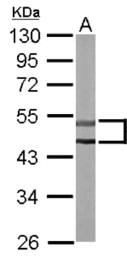 STK32C Antibody, Novus Biologicals 0.1mL; Unlabeled:Antibodies, Polyclonal