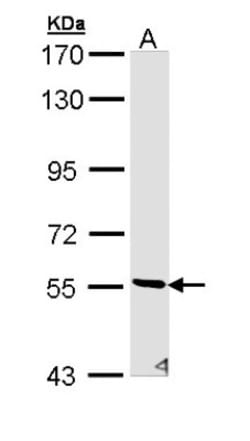 STK32C Antibody, Novus Biologicals 0.1mL; Unlabeled:Antibodies, Polyclonal