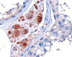 STK35 Antibody, Novus Biologicals 0.1mg; Unlabeled:Antibodies, Polyclonal