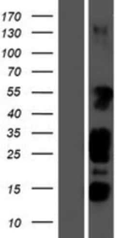Novus Biologicals™ STK35 Overexpression Lysate