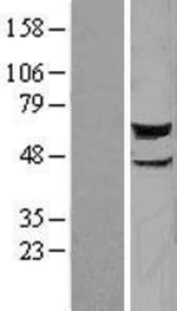 Novus Biologicals&trade;&nbsp;STK38 Overexpression Lysate