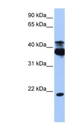 STK38 Antibody, Novus Biologicals 100&mu;L; Unlabeled:Antibodies, Polyclonal