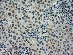 STK39 Antibody (OTI4E3), Novus Biologicals 0.1mL; Unlabeled:Antibodies,