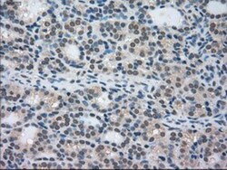 STK39 Antibody (OTI4E3), Novus Biologicals 0.1mL; Unlabeled:Antibodies,