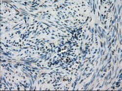 STK39 Antibody (OTI4E3), Novus Biologicals 0.1mL; Unlabeled:Antibodies,