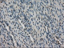 STK39 Antibody (OTI4E3), Novus Biologicals 0.1mL; Unlabeled:Antibodies,