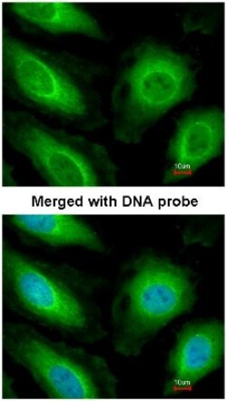 STK4 Antibody, Novus Biologicals 0.1mg; Unlabeled:Antibodies, Polyclonal