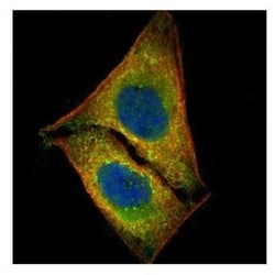 STK4 Antibody, Novus Biologicals 0.1mg; Unlabeled:Antibodies, Polyclonal