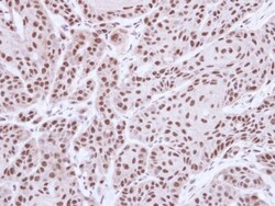 STK4 Antibody, Novus Biologicals 0.1mg; Unlabeled:Antibodies, Polyclonal