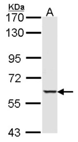 STK4 Antibody, Novus Biologicals 0.1mg; Unlabeled:Antibodies, Polyclonal