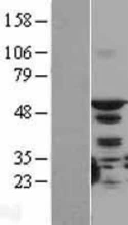 Novus Biologicals&trade;&nbsp;STK4 Overexpression Lysate