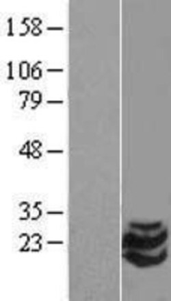 Novus Biologicals&trade;&nbsp;Stathmin-2/STMN2 Overexpression Lysate