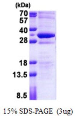 Novus Biologicals Recombinant Human STMN4 His Protein 0.1 mg | Buy Online | Novus Biologicals&trade; | Fisher Scientific