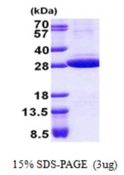 Novus Biologicals&trade;&nbsp;Recombinant Human Stomatin His Protein