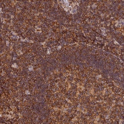 Stomatin-like protein 1 Antibody, Novus Biologicals 25 &mu;L, Unlabeled:Antibodies,