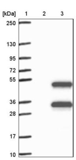 Stomatin-like protein 1 Antibody, Novus Biologicals 25 &mu;L, Unlabeled:Antibodies,