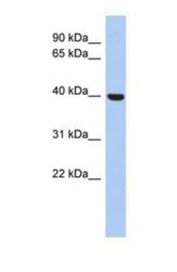STOML3 Antibody, Novus Biologicals 100 &mu;L | Buy Online | Novus Biologicals | Fisher Scientific