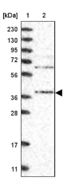 STRAP Antibody, Novus Biologicals 0.1mL; Unlabeled:Antibodies, Polyclonal