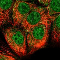 STRAP Antibody, Novus Biologicals 0.1mL; Unlabeled:Antibodies, Polyclonal