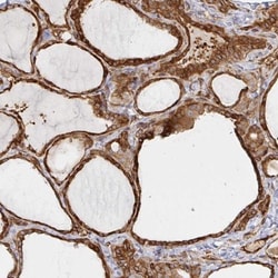 STRAP Antibody, Novus Biologicals 0.1mL; Unlabeled:Antibodies, Polyclonal