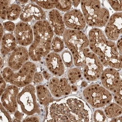 STRAP Antibody, Novus Biologicals 0.1mL; Unlabeled:Antibodies, Polyclonal