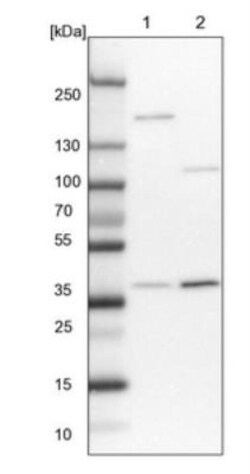 STRAP Antibody, Novus Biologicals 0.1mL; Unlabeled:Antibodies, Polyclonal