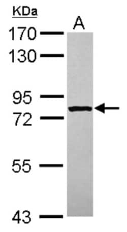 STRBP Antibody, Novus Biologicals 0.1mL; Unlabeled:Antibodies, Polyclonal