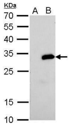 Strep II Tag Antibody (517), Novus Biologicals 0.1mL; Unlabeled:Antibodies,