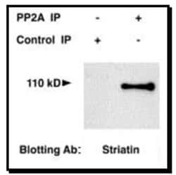 Striatin Antibody, Novus Biologicals 0.1mL; Unlabeled:Antibodies, Polyclonal