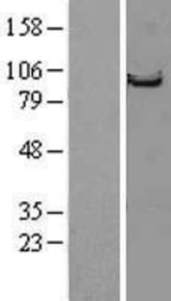 Novus Biologicals&trade;&nbsp;Striatin Overexpression Lysate