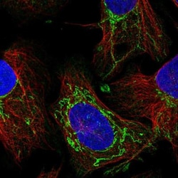 STRN4 Antibody, Novus Biologicals 0.1mL; Unlabeled:Antibodies, Polyclonal