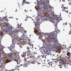 STRN4 Antibody, Novus Biologicals 0.1mL; Unlabeled:Antibodies, Polyclonal