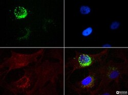 STRO-1 Antibody (STRO-1), Novus Biologicals:Antibodies:Primary Antibodies