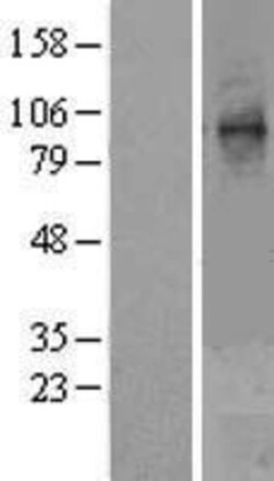Novus Biologicals&trade;&nbsp;STT3A Overexpression Lysate