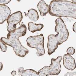 STT3A Antibody, Novus Biologicals:Antibodies:Primary Antibodies