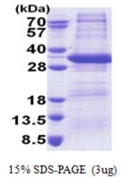 Novus Biologicals&trade;&nbsp;Recombinant Human STX17 His Protein
