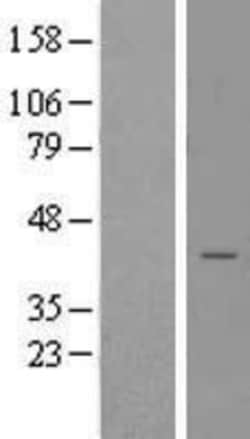 Novus Biologicals&trade;&nbsp;STX18 Overexpression Lysate