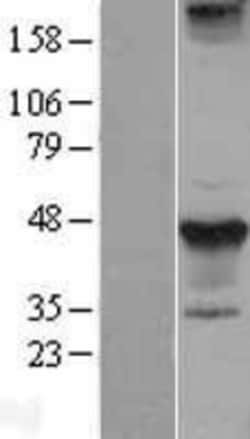 Novus Biologicals&trade;&nbsp;STYK1 Overexpression Lysate
