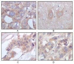 STYK1 Antibody (2H2F10), Novus Biologicals 0.1mL; Unlabeled:Antibodies,